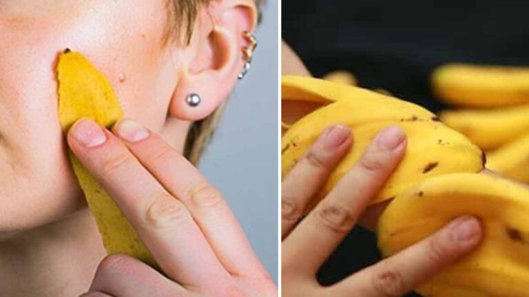 Voici pourquoi il faut frotter la peau de banane sur son visage une fois par semaine