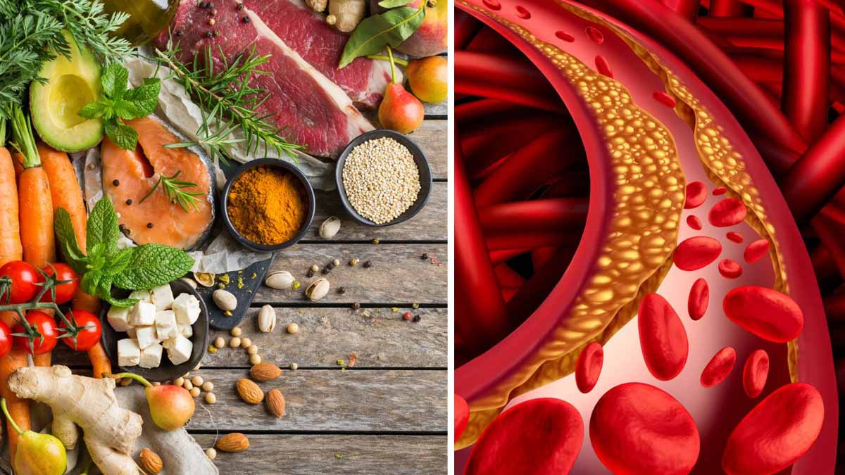 10 aliments pour conserver la santé de vos artères et réduire le cholestérol