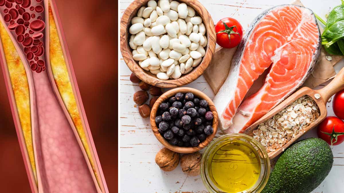 Cholestérol voici 6 aliments courants qui amplifient le taux et bouchent les artères, ne les mangez pas !