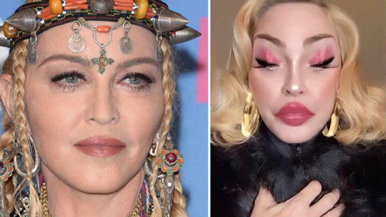 Madonna a 64 ans son visage est déformé, les fans sont choqués !