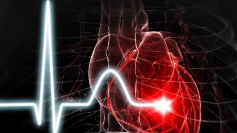 Palpitations cardiaques les 5 causes les plus fréquentes selon un cardiologue